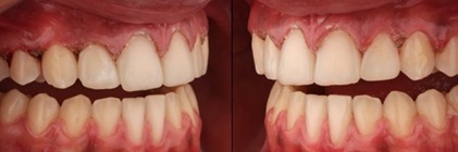 hình 6a tổng hợp các góc chụp hậu phẫu tức thì