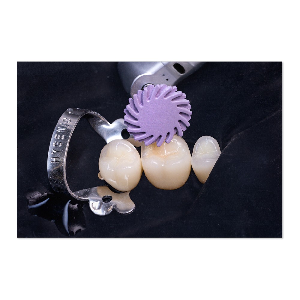 kenda nobilis - đầu đánh bóng kim cương 1 bước 4 kenda nobilis - đầu đánh bóng kim cương 1 bước - ảnh 4